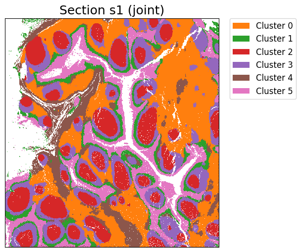 ../_images/notebooks_Tutorial11_Tonsil%2810x_Visium_Spatial_Gene_Protein%29_21_1.png