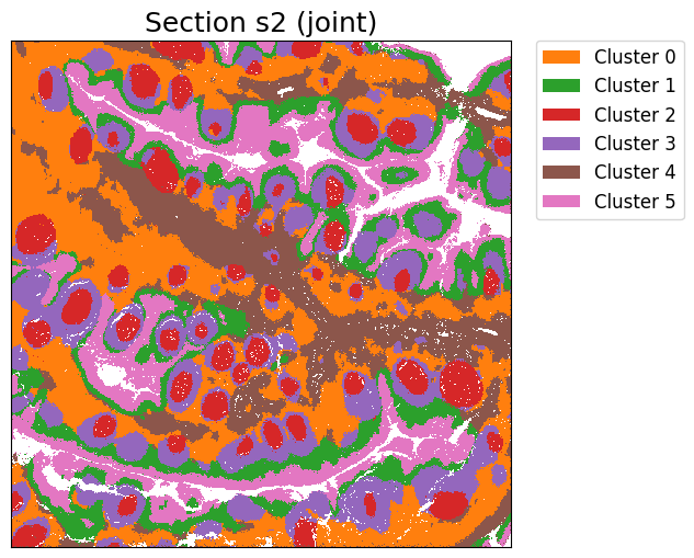 ../_images/notebooks_Tutorial11_Tonsil%2810x_Visium_Spatial_Gene_Protein%29_21_2.png